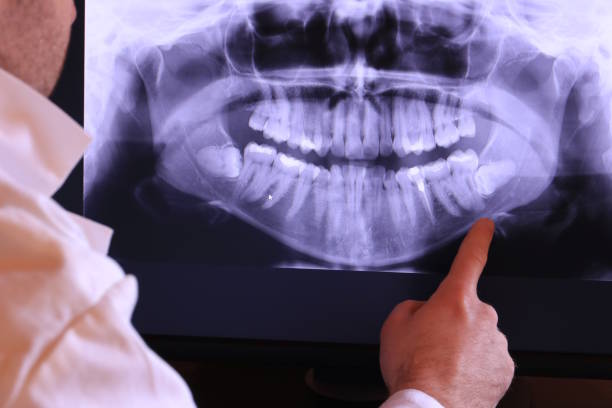 Best Same-Day Emergency Dentist in Massanutten, VA