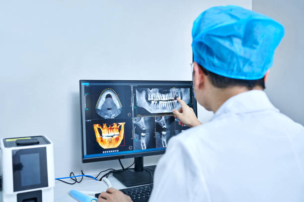Best Emergency Tooth Extraction in Massanutten, VA