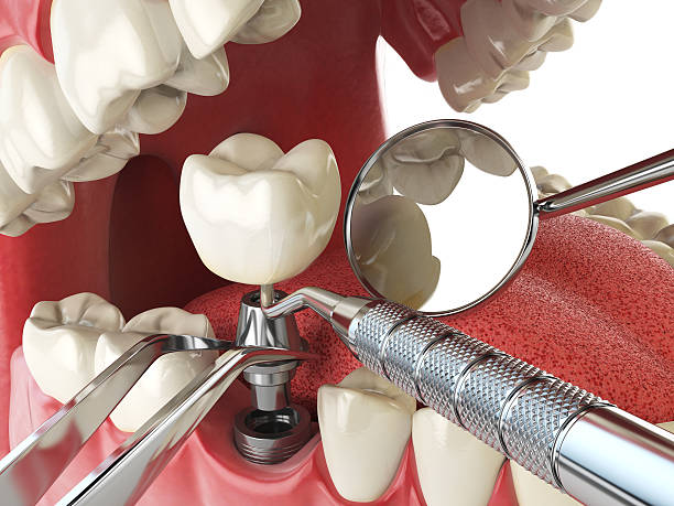 Best Emergency Treatment for Toothache in Massanutten, VA